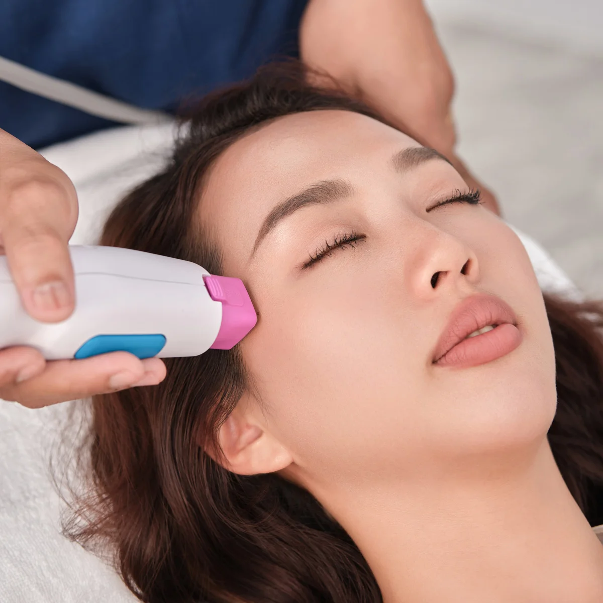 Điều trị làm săn chắc và nâng cơ Firmalift™ bằng sóng cao tần