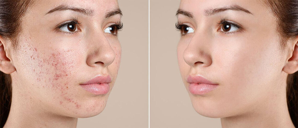 Before & After