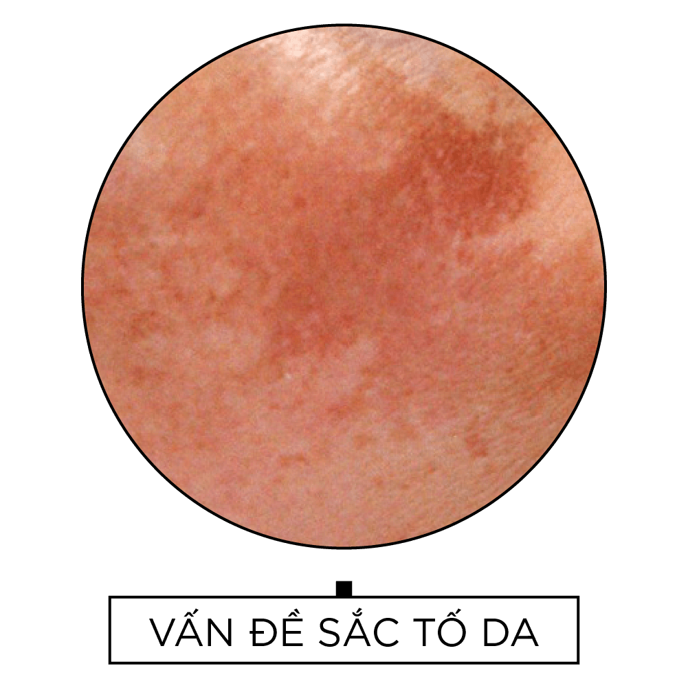 Vấn đề da